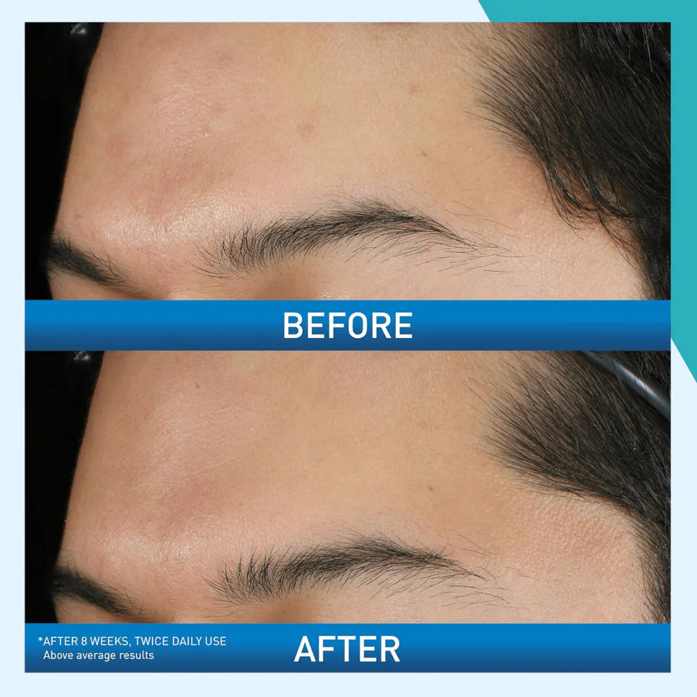 Acne Control Foaming Cream Face Wash CeraVe 150ML